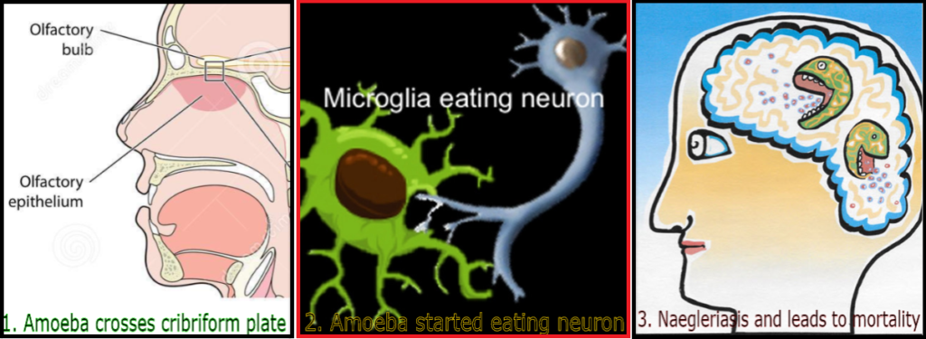 Severity of Brain eating amoeba Naegleria fowleri