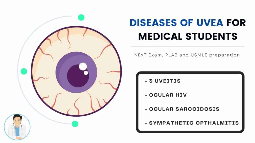Diseases of Uvea for Medical Students - Free NExT, PLAB and USMLE Notes and MCQs
