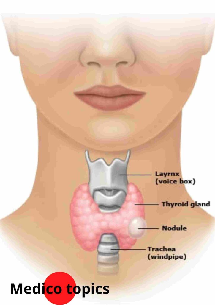 Symptoms of Thyroid cancer