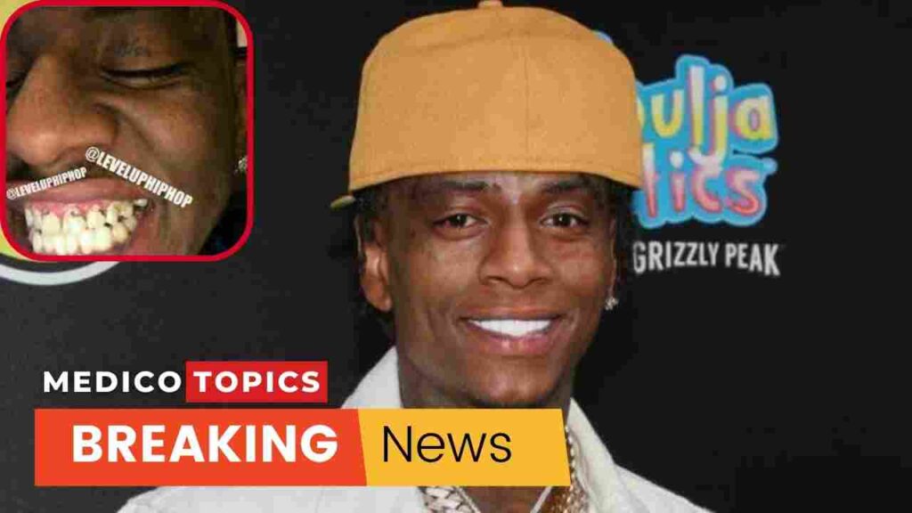 What happened to Soulja Boy's teeth? Teeth transformation Explained