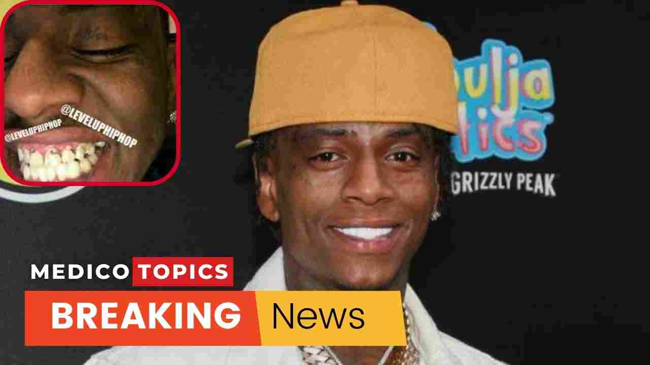 Soulja Boy's Teeth transformation - Medico topics - News Hub | Latest