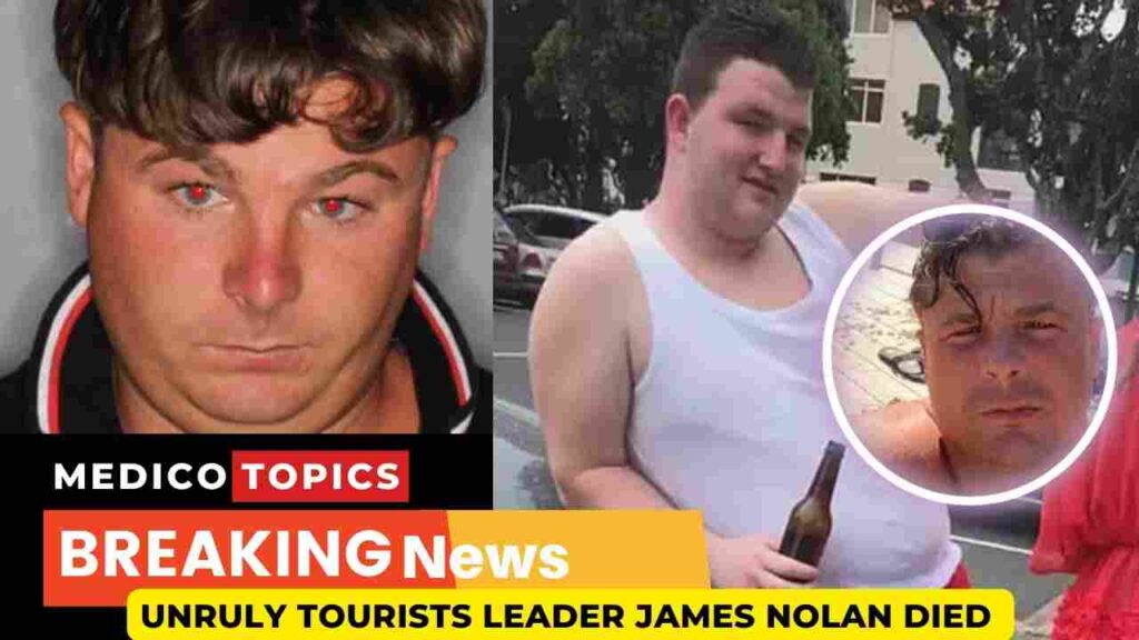 How did James Anthony Nolan die? Unruly tourists leader Cause of death