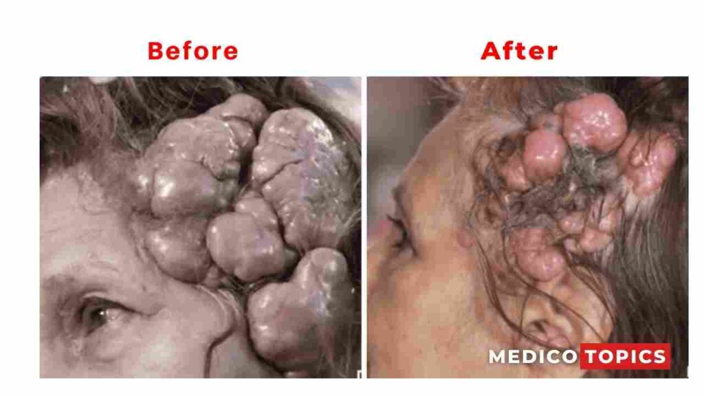 Before and after surgery pictures