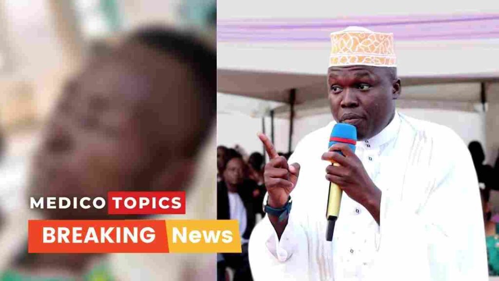 Abdallah Babu cause of death