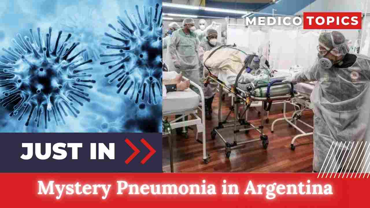 Mystery Pneumonia in Argentina What is the origin? Revealed