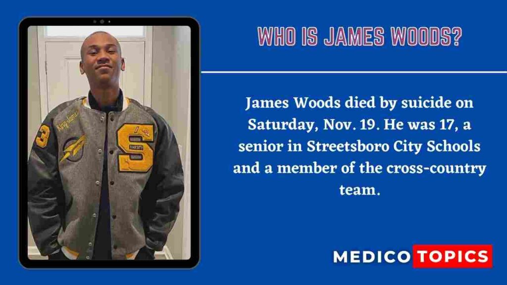 Who is James Woods?